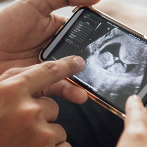 Questions to ask at your 12-week Scan